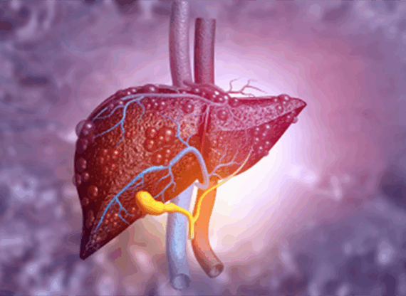 HEPATOBILIARY3